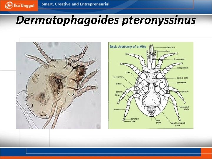Dermatophagoides pteronyssinus 