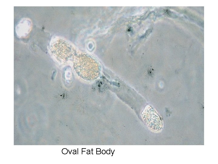 Oval Fat Body 