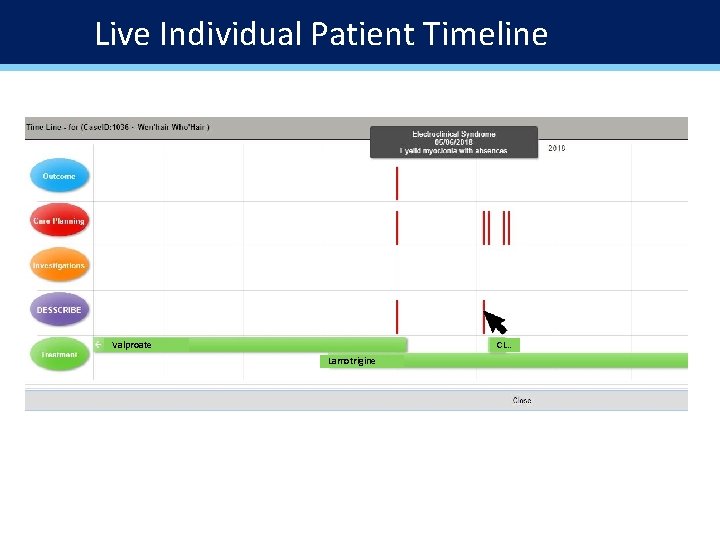 Live Individual Patient Timeline Valproate CL. . Lamotrigine 