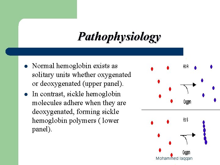 Pathophysiology l l Normal hemoglobin exists as solitary units whether oxygenated or deoxygenated (upper