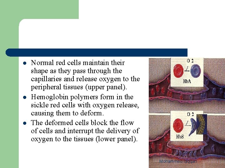 l l l Normal red cells maintain their shape as they pass through the