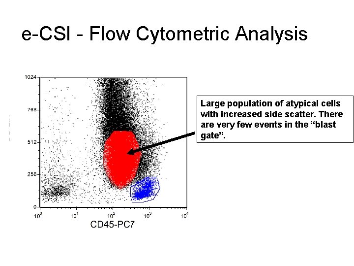 e-CSI - Flow Cytometric Analysis Large population of atypical cells with increased side scatter.