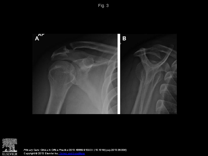 Fig. 3 Primary Care: Clinics in Office Practice 2013 40889 -910 DOI: (10. 1016/j.