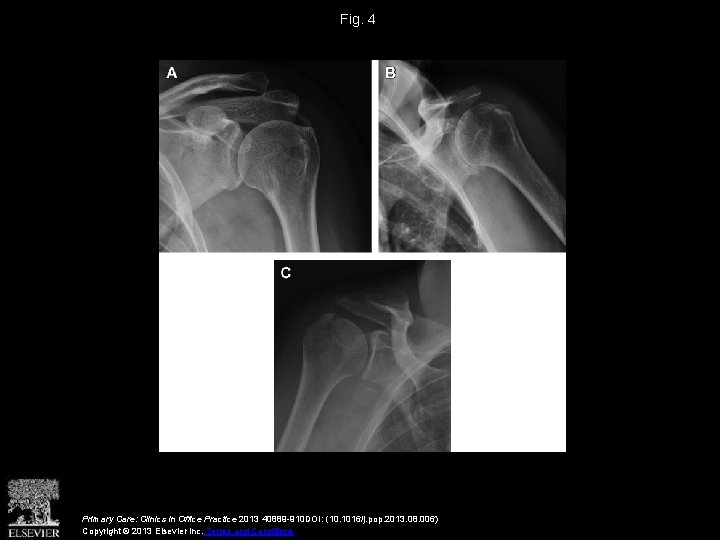 Fig. 4 Primary Care: Clinics in Office Practice 2013 40889 -910 DOI: (10. 1016/j.