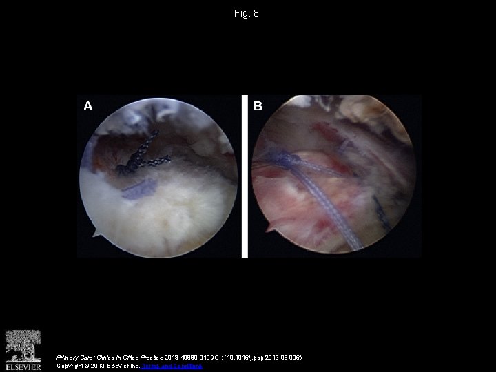 Fig. 8 Primary Care: Clinics in Office Practice 2013 40889 -910 DOI: (10. 1016/j.