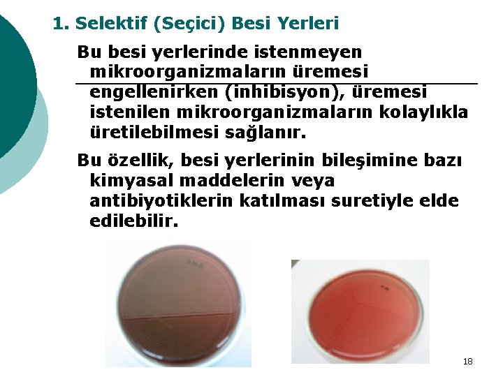 1. Selektif (Seçici) Besi Yerleri Bu besi yerlerinde istenmeyen mikroorganizmaların üremesi engellenirken (inhibisyon), üremesi