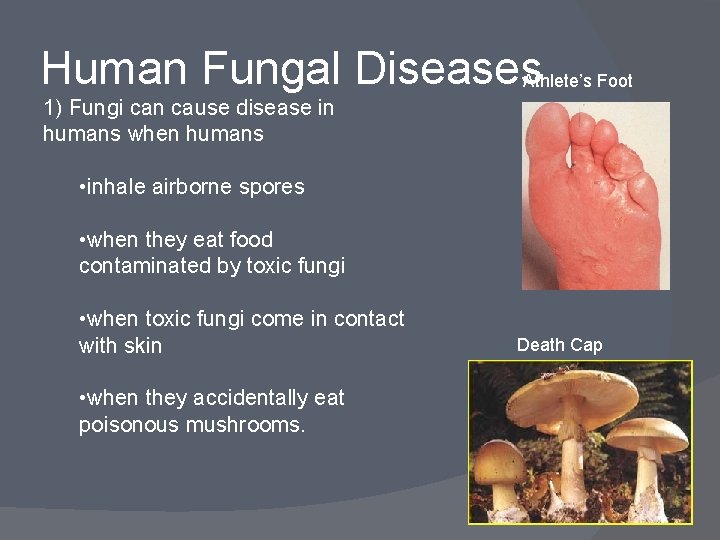 Human Fungal Diseases Athlete’s Foot 1) Fungi can cause disease in humans when humans