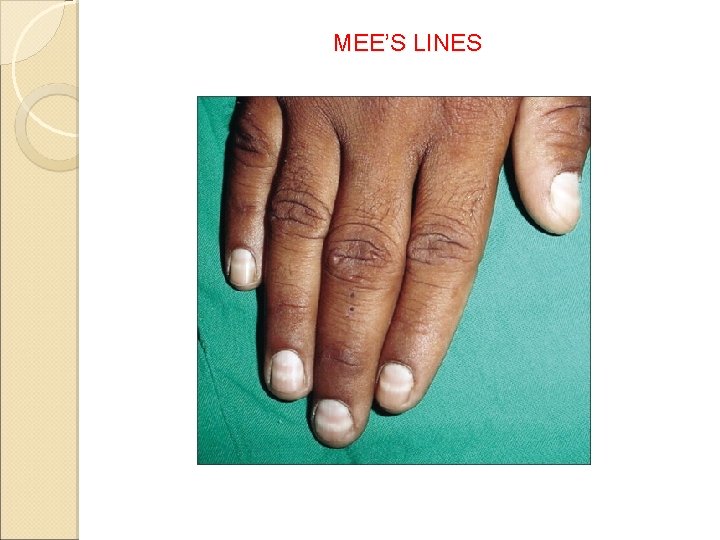 MEE’S LINES 