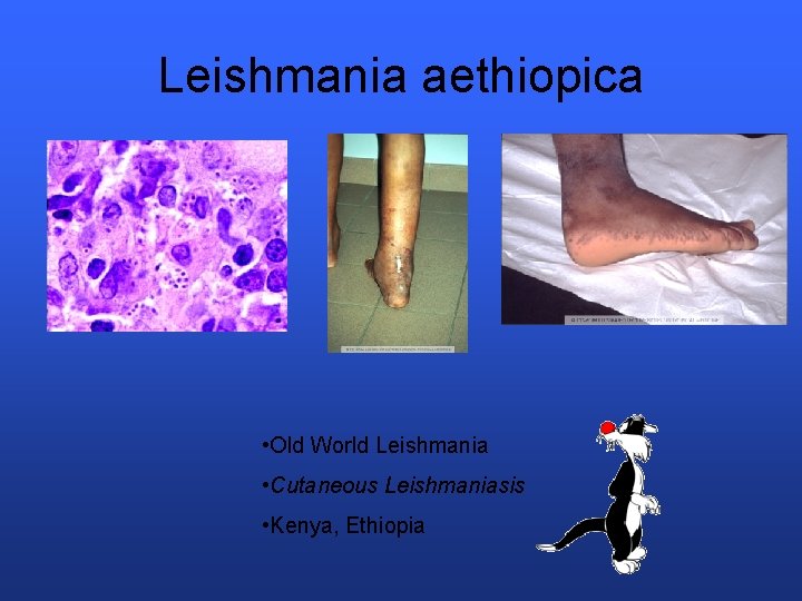 Leishmania aethiopica • Old World Leishmania • Cutaneous Leishmaniasis • Kenya, Ethiopia 