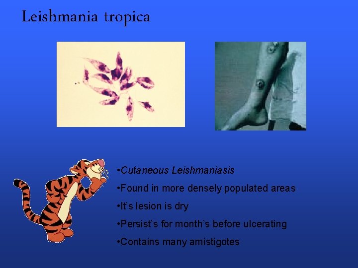 Leishmania tropica • Cutaneous Leishmaniasis • Found in more densely populated areas • It’s