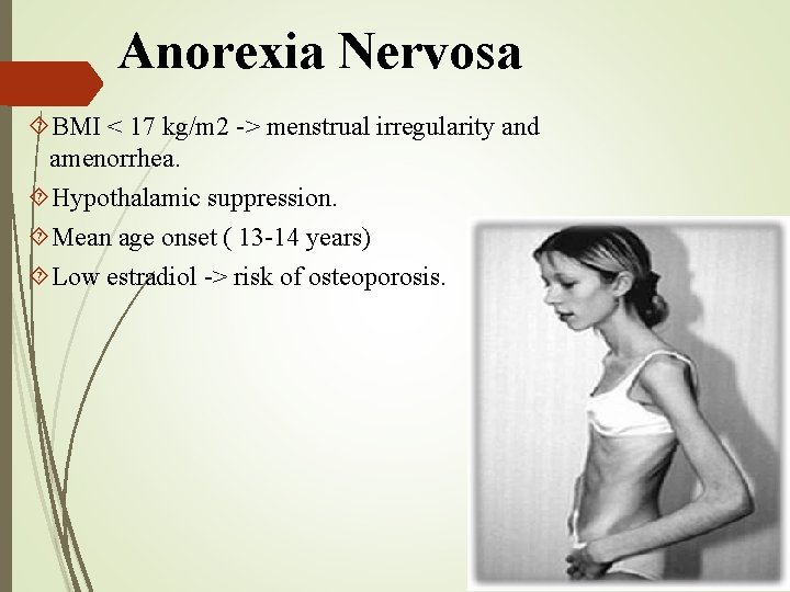 Anorexia Nervosa BMI < 17 kg/m 2 -> menstrual irregularity and amenorrhea. Hypothalamic suppression.