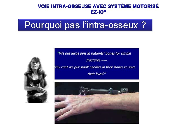 VOIE INTRA-OSSEUSE AVEC SYSTÈME MOTORISÉ EZ-IO® Pourquoi pas l’intra-osseux ? 