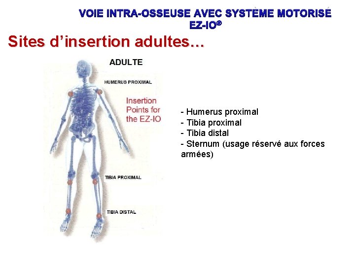 VOIE INTRA-OSSEUSE AVEC SYSTÈME MOTORISÉ EZ-IO® Sites d’insertion adultes… - Humerus proximal - Tibia