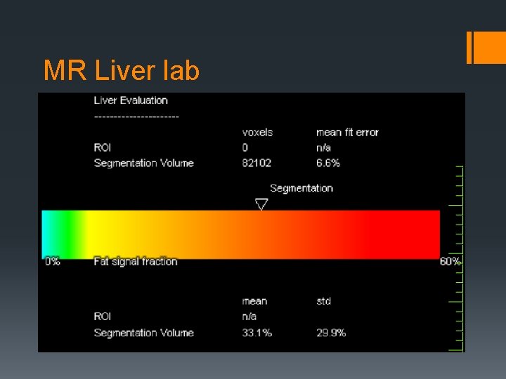 MR liver lab and MR Elastography How do