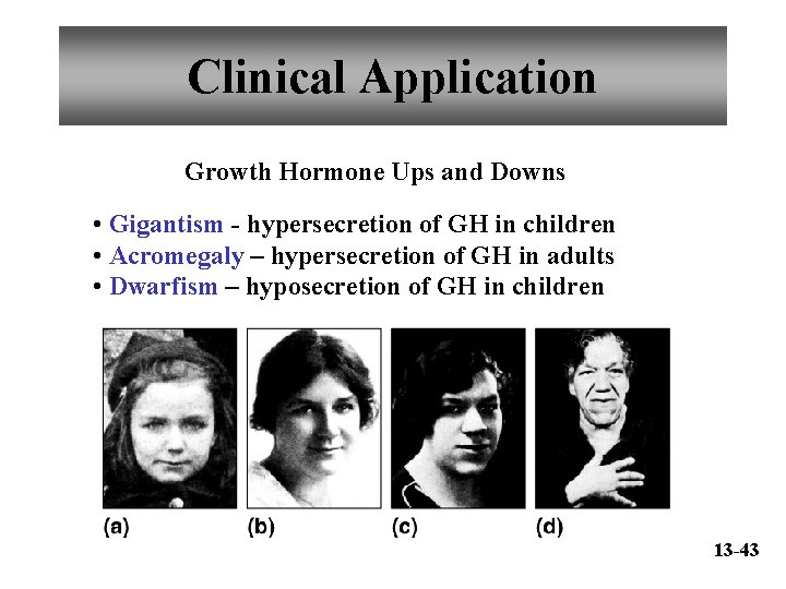 Clinical Application Growth Hormone Ups and Downs • Gigantism - hypersecretion of GH in