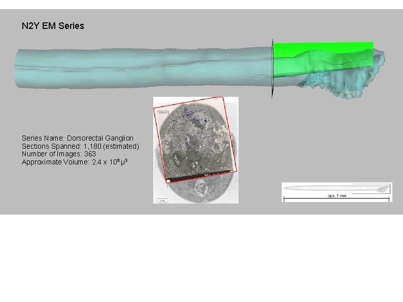 N 2 Y EM Series Name: Dorsorectal Dorsal Cord Ganglion Sections Spanned: 1, 180