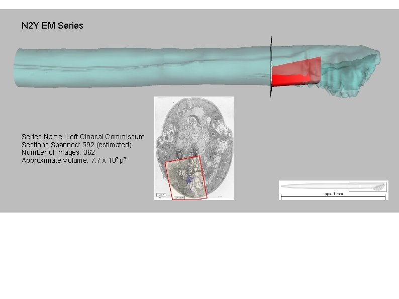 N 2 Y EM Series Name: Left Dorsal Dorsorectal Cloacal Cord Ganglion Commissure Sections