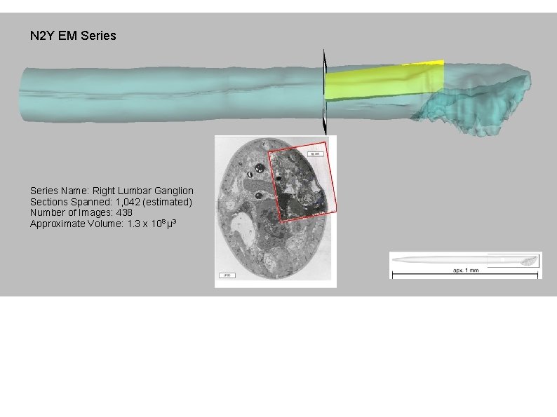 N 2 Y EM Series Name: Right Lumbar Ganglion Sections Spanned: 1, 042 (estimated)