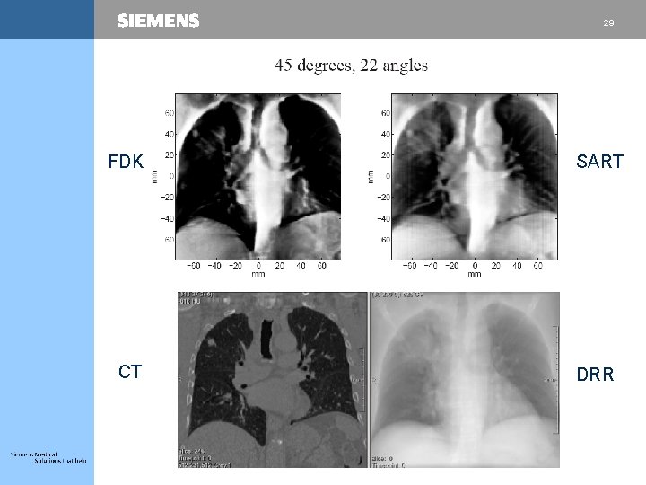 Volumetric conebeam reconstruction engines for 4 D image