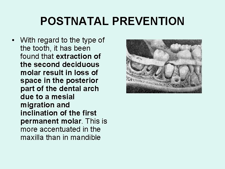 POSTNATAL PREVENTION • With regard to the type of the tooth, it has been