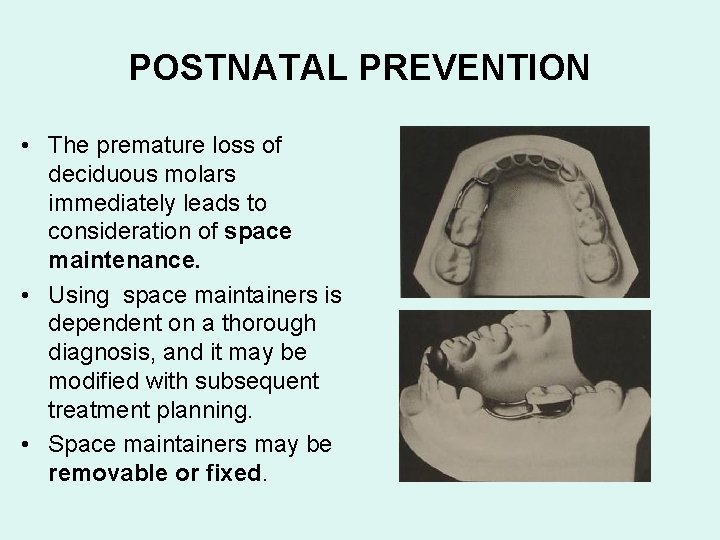 POSTNATAL PREVENTION • The premature loss of deciduous molars immediately leads to consideration of