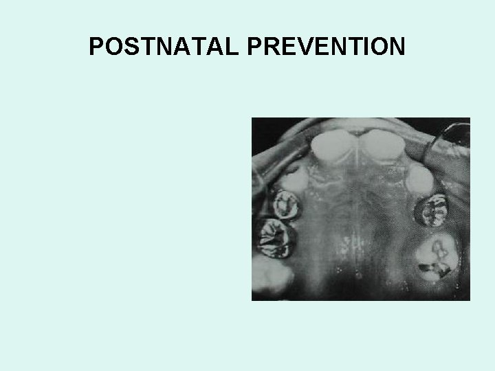 POSTNATAL PREVENTION 