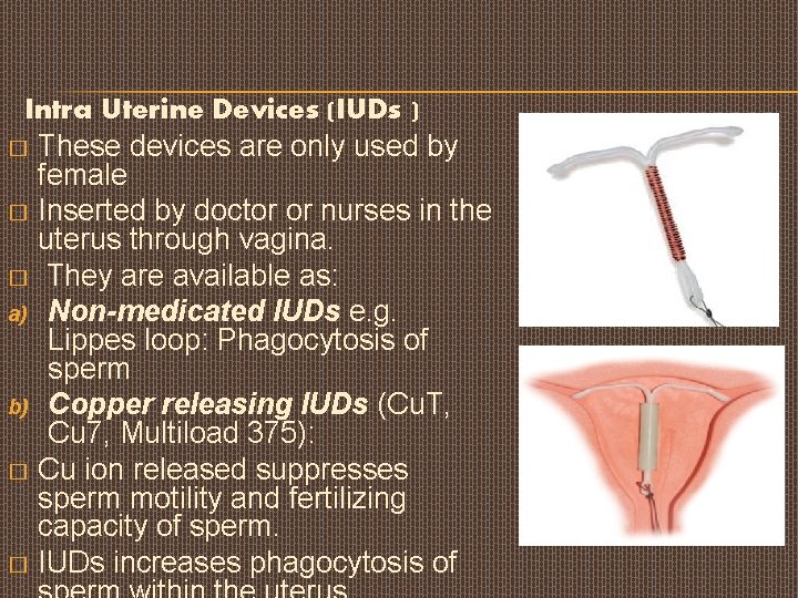 Intra Uterine Devices (IUDs ) � These devices are only used by female �