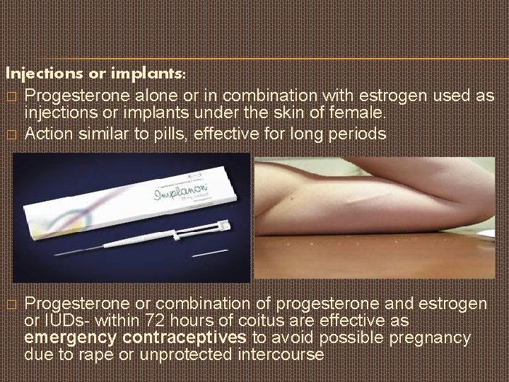 Injections or implants: � Progesterone alone or in combination with estrogen used as injections