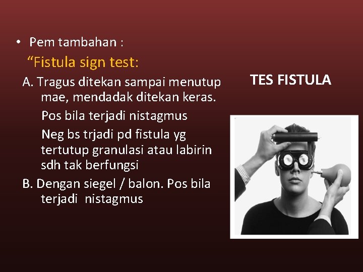  • Pem tambahan : “Fistula sign test: A. Tragus ditekan sampai menutup mae,