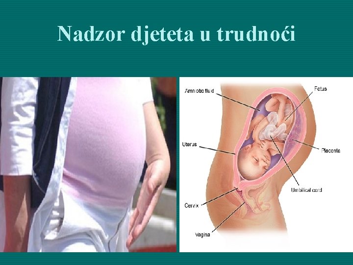 Nadzor djeteta u trudnoći 