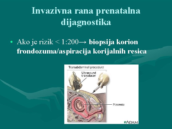 Invazivna rana prenatalna dijagnostika • Ako je rizik < 1: 200→ biopsija korion frondozuma/aspiracija