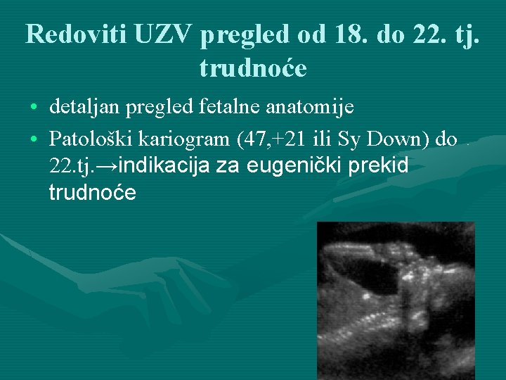 Redoviti UZV pregled od 18. do 22. tj. trudnoće • detaljan pregled fetalne anatomije