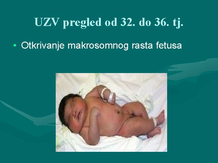 UZV pregled od 32. do 36. tj. • Otkrivanje makrosomnog rasta fetusa 