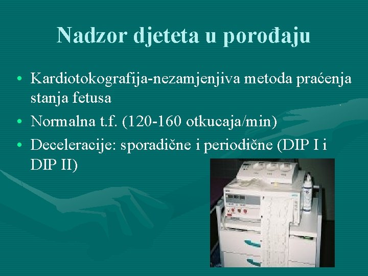 Nadzor djeteta u porođaju • Kardiotokografija-nezamjenjiva metoda praćenja stanja fetusa • Normalna t. f.