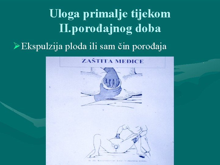 Uloga primalje tijekom II. porođajnog doba Ø Ekspulzija ploda ili sam čin porođaja 