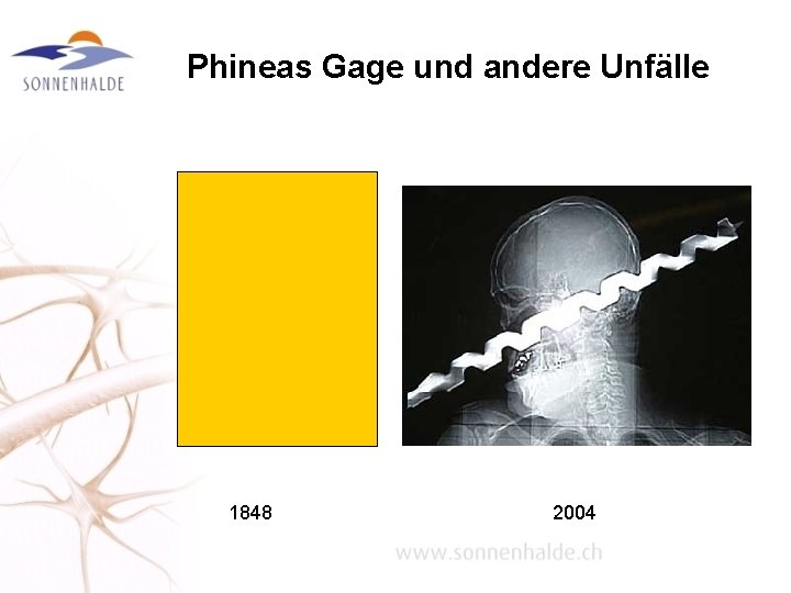 Phineas Gage und andere Unfälle 1848 2004 