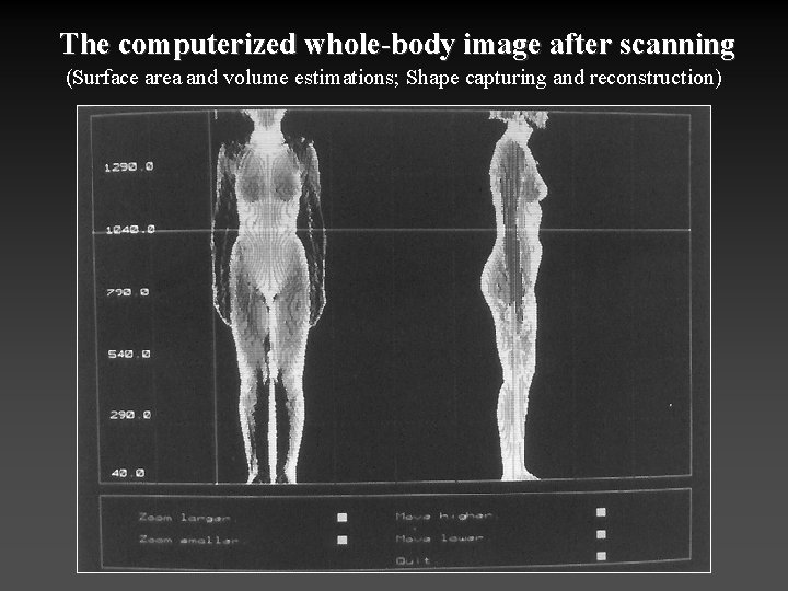 The computerized whole-body image after scanning (Surface area and volume estimations; Shape capturing and