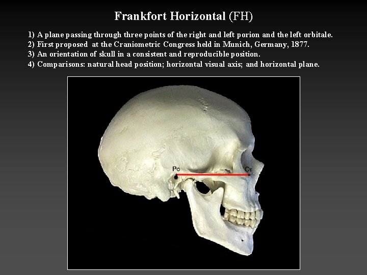Frankfort Horizontal (FH) 1) A plane passing through three points of the right and
