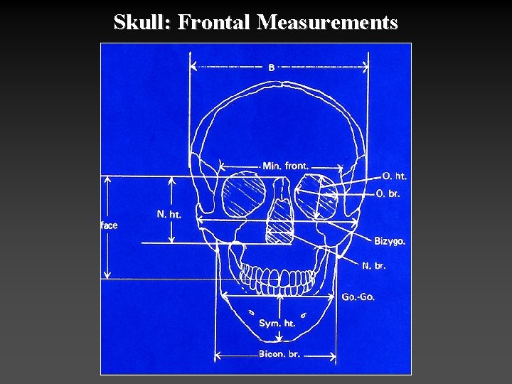 Skull: Frontal Measurements 