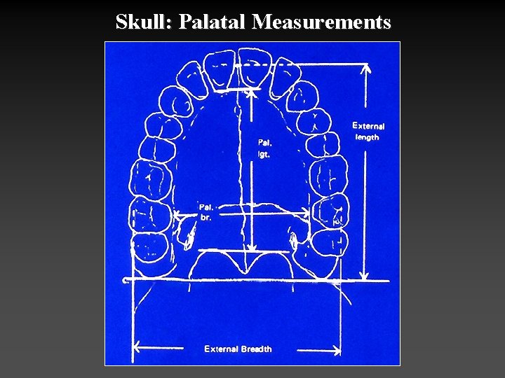 Skull: Palatal Measurements 