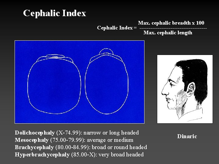 Cephalic Index Max. cephalic breadth x 100 Cephalic Index = ------------------Max. cephalic length Dolichocephaly