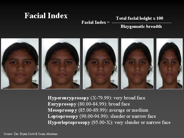 Facial Index Total facial height x 100 Facial Index = -------------------Bizygomatic breadth Hypereuryprosopy (X-79.