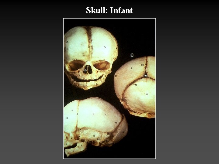 Skull: Infant 