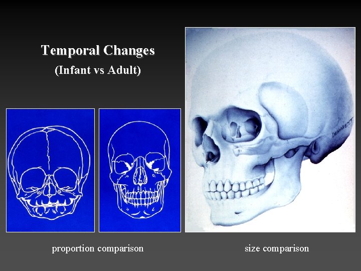 Temporal Changes (Infant vs Adult) proportion comparison size comparison 