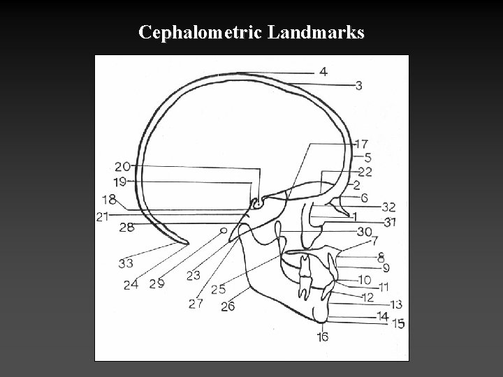 Cephalometric Landmarks 