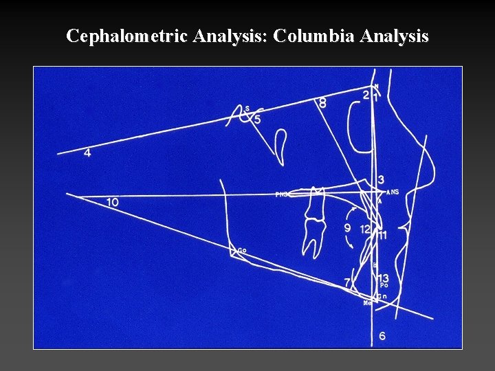 Cephalometric Analysis: Columbia Analysis 