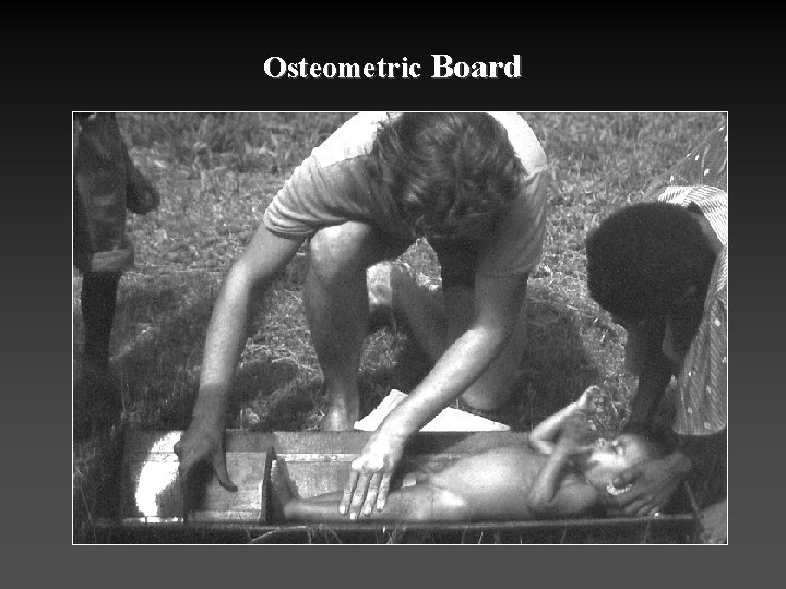 Osteometric Board 