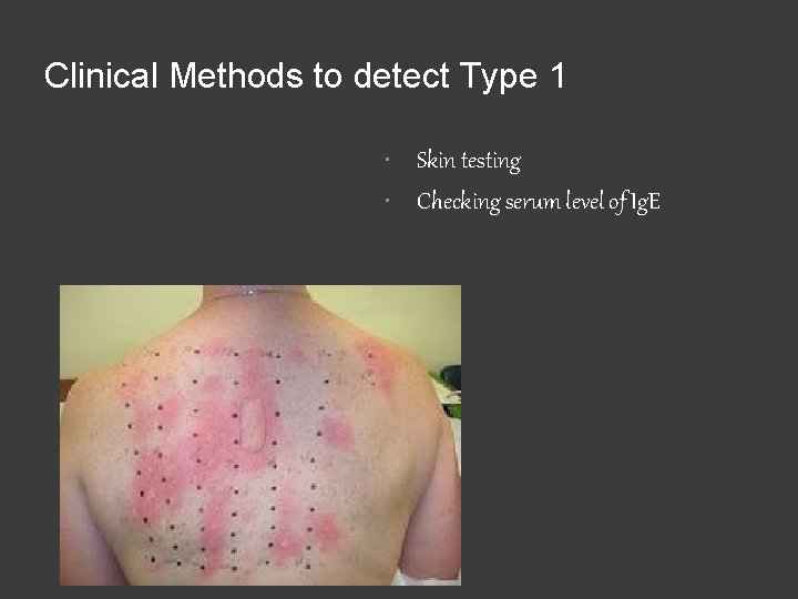 Clinical Methods to detect Type 1 Skin testing Checking serum level of Ig. E