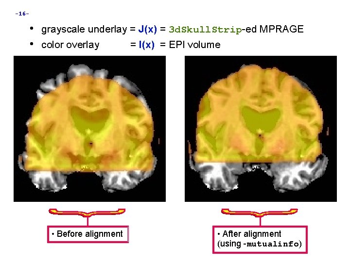 -16 - • grayscale underlay = J(x) = 3 d. Skull. Strip-ed MPRAGE •