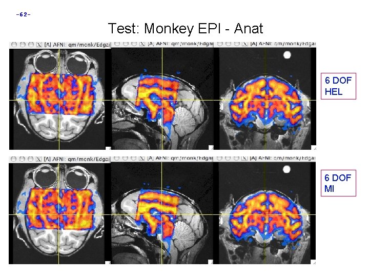 -62 - Test: Monkey EPI - Anat 6 DOF HEL 6 DOF MI 
